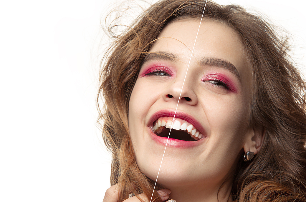 Girl smiling with teeth on show