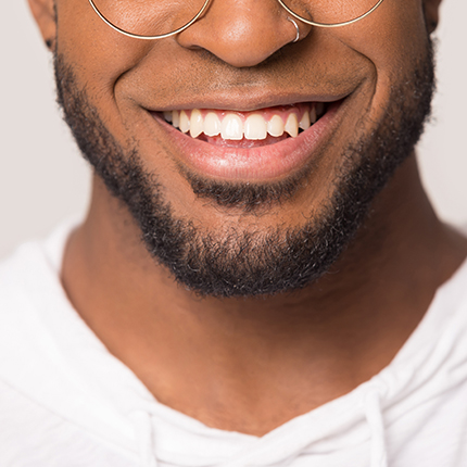 Bright smile with cleaned and polished teeth by a dental hygienist